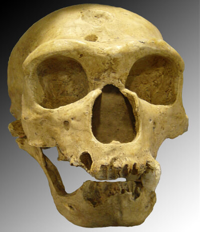 Data-driven research shows that Neanderthal gene connected to severity of COVID-19